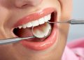 Dental Filling Options