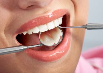 Dental Filling Options