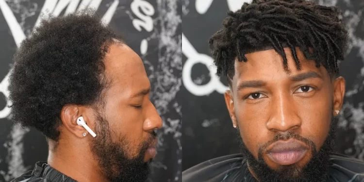The Rise of ‘Man Weave’: Revolutionizing Men’s Hair Solutions