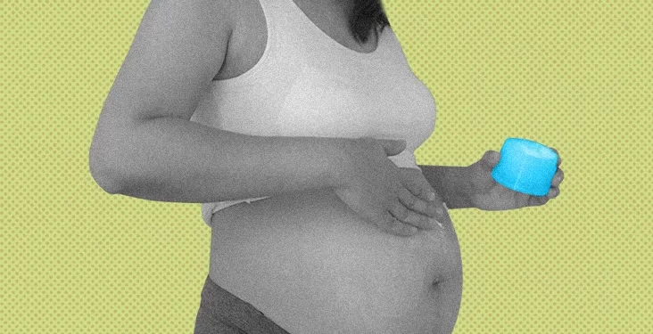 What are the ingredients in stretch mark creams?