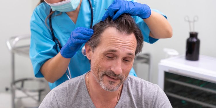 Hair Transplant Turkey: The Ultimate Solution for Hair Restoration