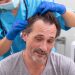 Hair Transplant Turkey: The Ultimate Solution for Hair Restoration