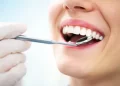Dental Implants: Your Comprehensive Guide