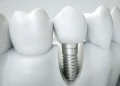 Cultivating Healthy Habits: The Role of Pediatric Dental Care