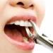 Understanding Dental Extractions: What You Need to Know