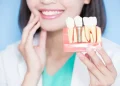 Reclaiming Smiles: The Transformative Power of Dental Implants