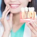 Reclaiming Smiles: The Transformative Power of Dental Implants